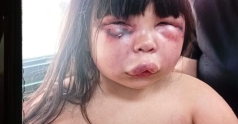 Feroz golpiza a una nena en Gerli: la atacó su padrastro y fue detenido